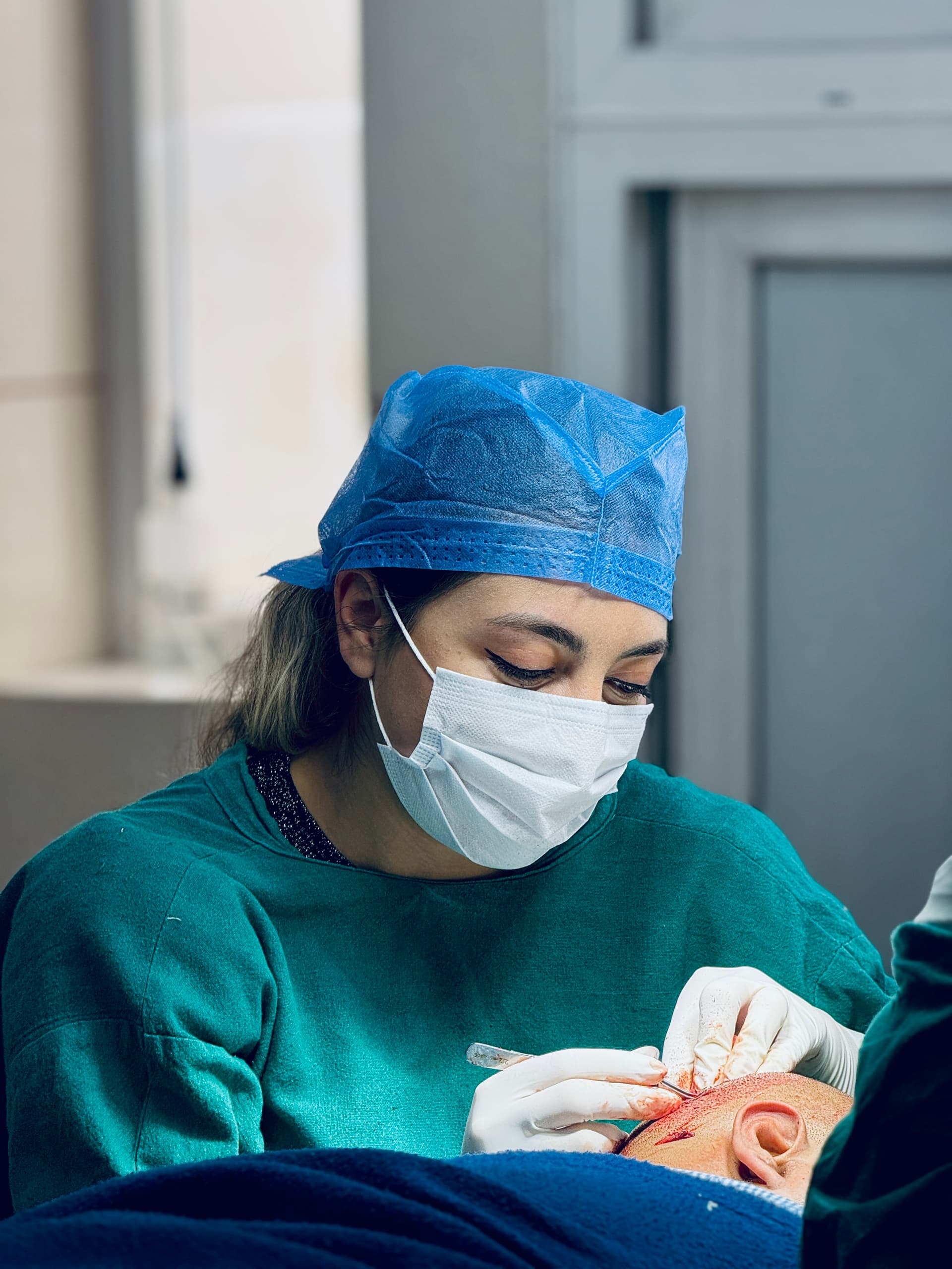 The Hidden Impact of Smoking on Hair Transplant Success
