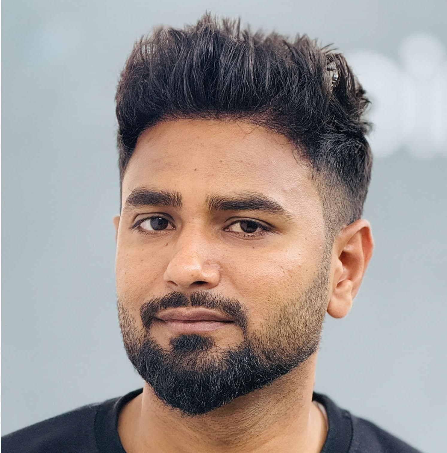 Hair transplant result 17