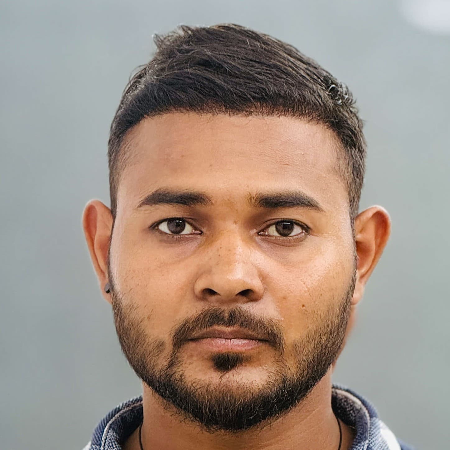 Hair transplant result 4