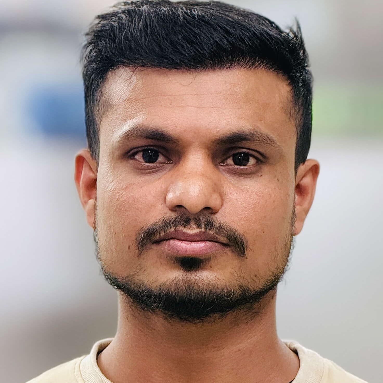 Hair transplant result 6