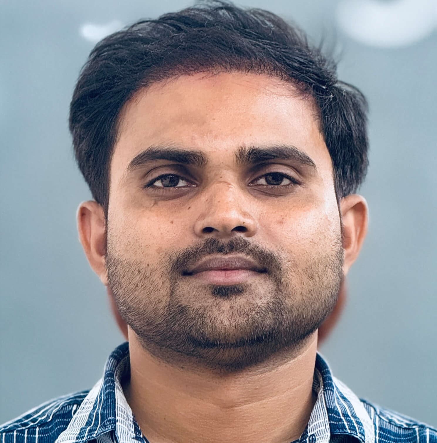 Hair transplant result 7
