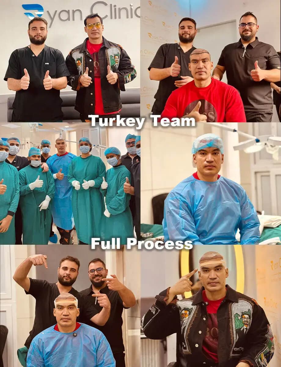 Turkey Team Process