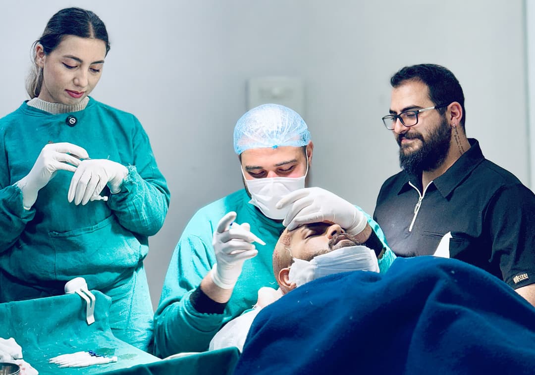 Hair transplant result — Ryan Clinic Delhi