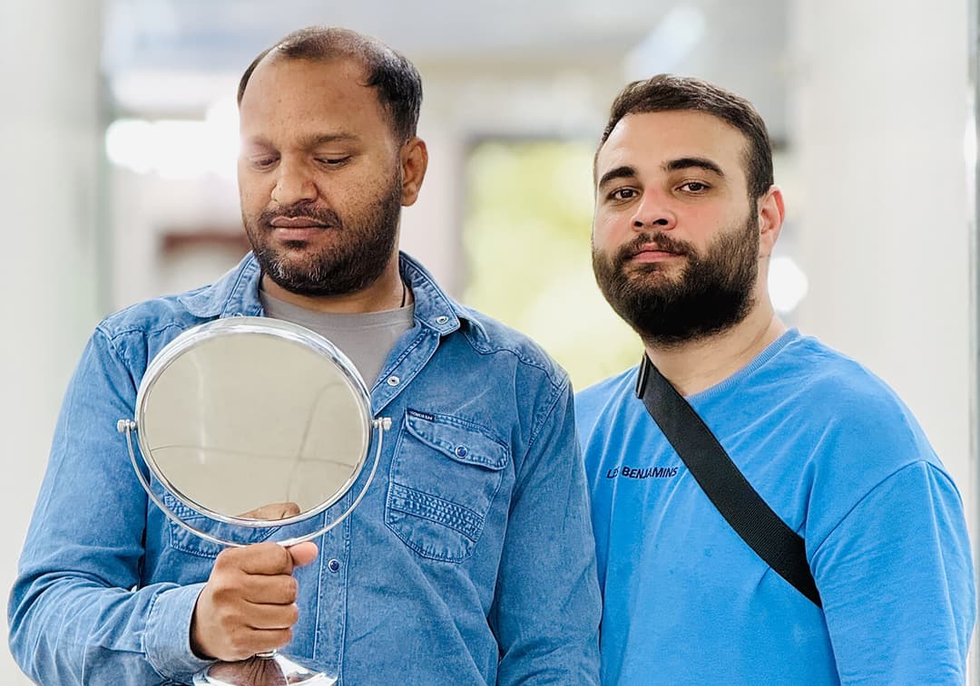 Hair transplant result — Ryan Clinic Mumbai