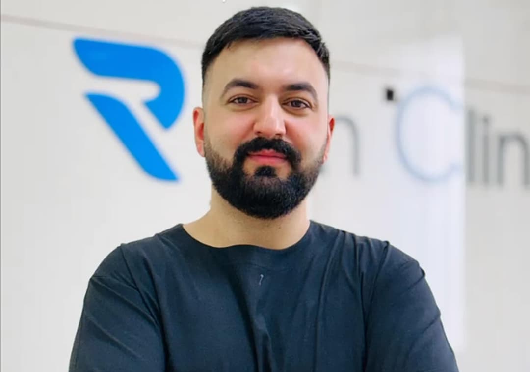 Hair transplant result — Ryan Clinic Hyderabad