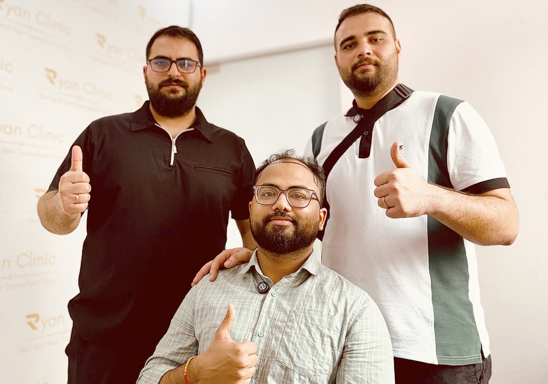 Hair transplant result — Ryan Clinic Hyderabad