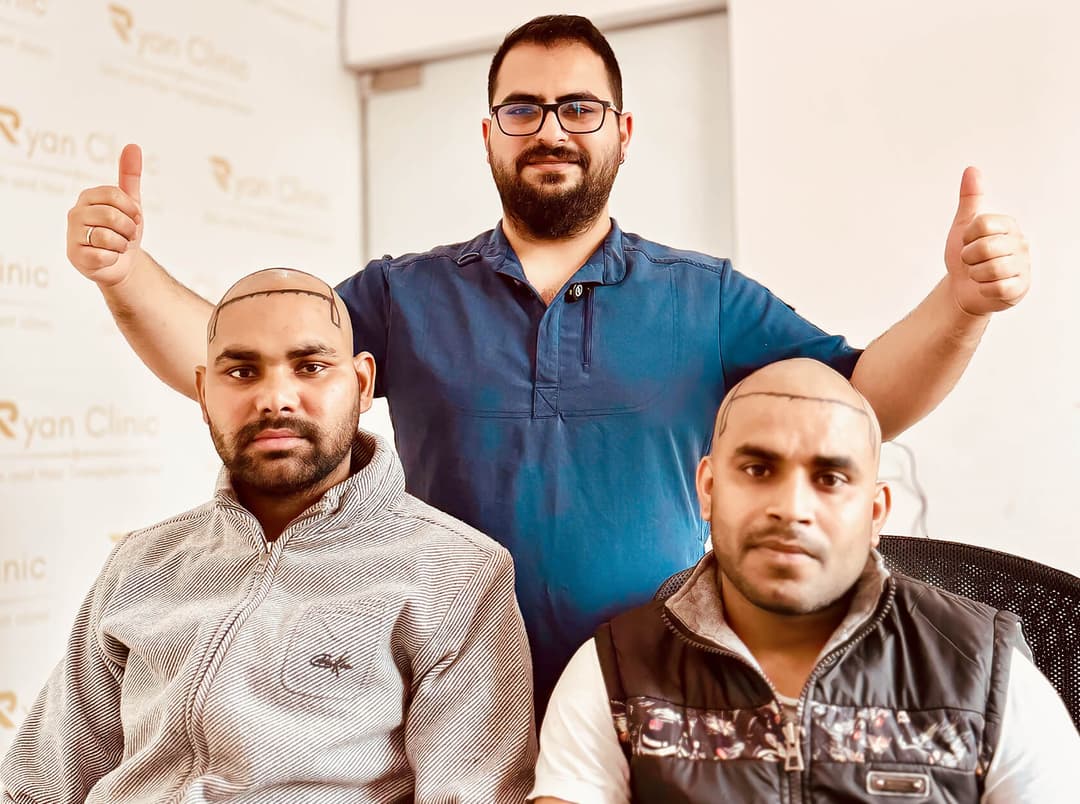 Hair transplant result — Ryan Clinic Hyderabad