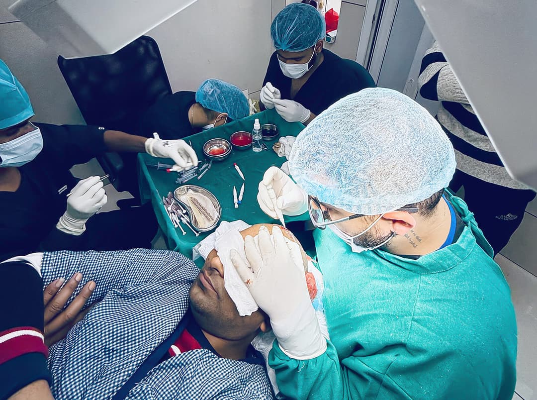 Hair transplant result — Ryan Clinic Hyderabad
