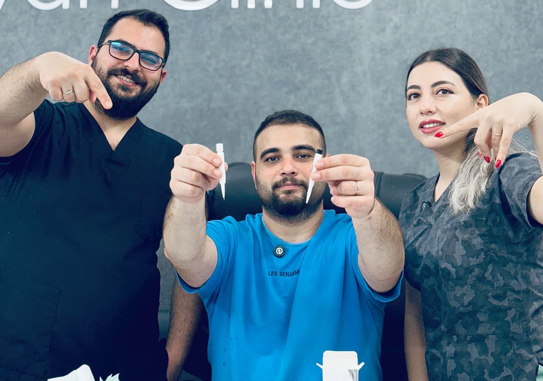 Hair transplant result — Ryan Clinic Delhi