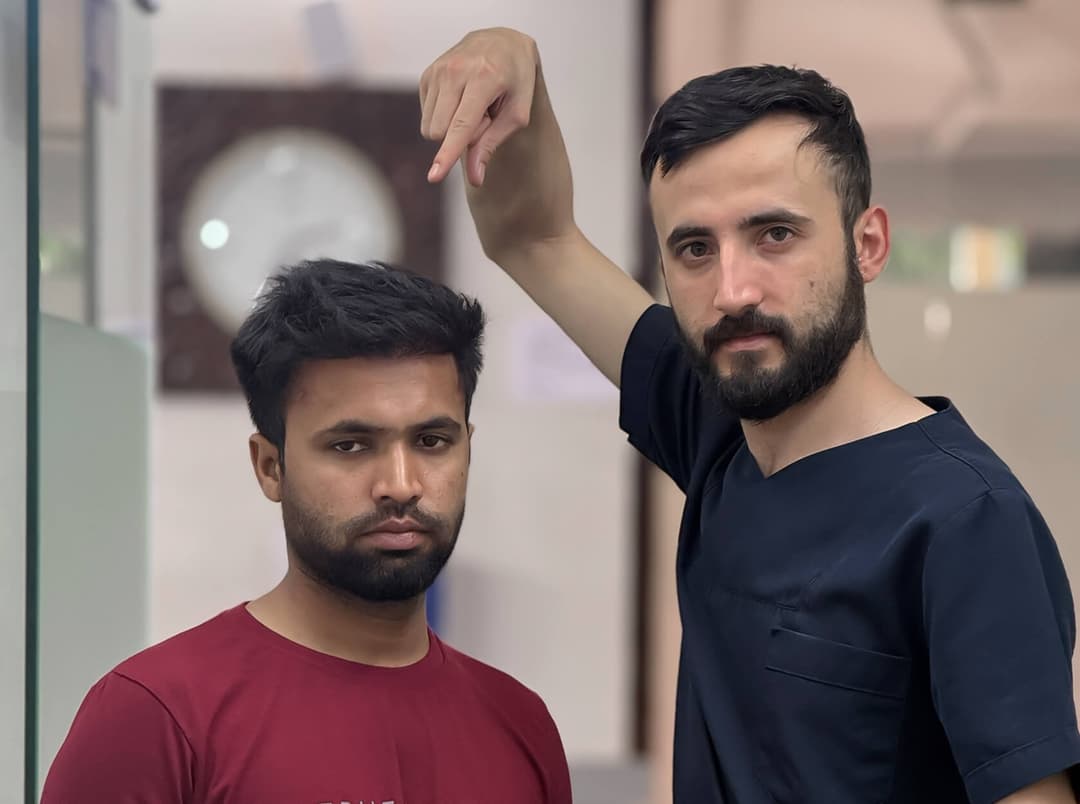 Hair transplant result — Ryan Clinic Hyderabad