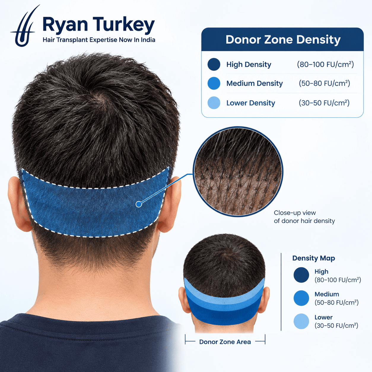 Measuring donor density
