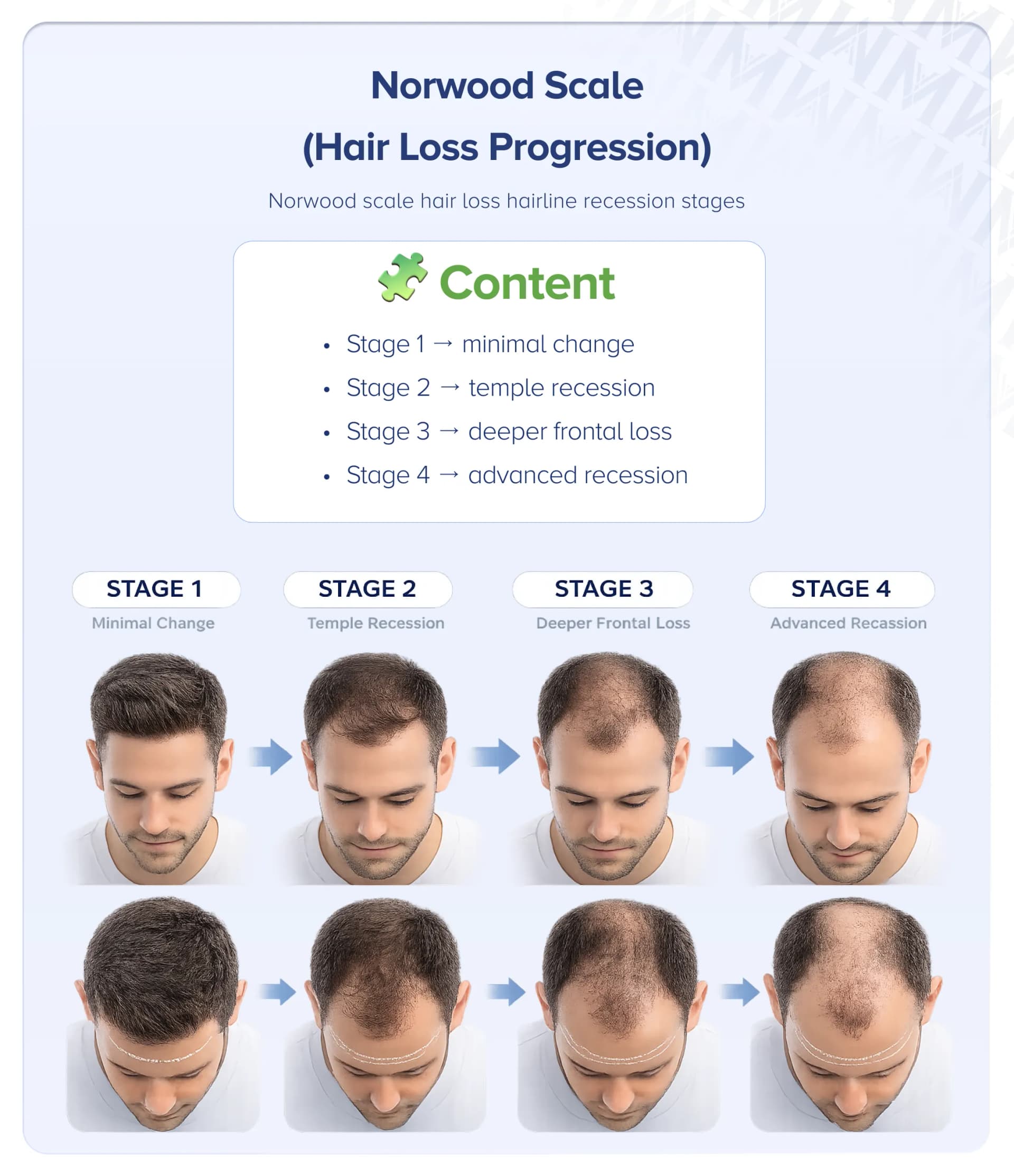 Doctor-Led vs Technician-Led Hair Transplant: Why It Decides Your Result