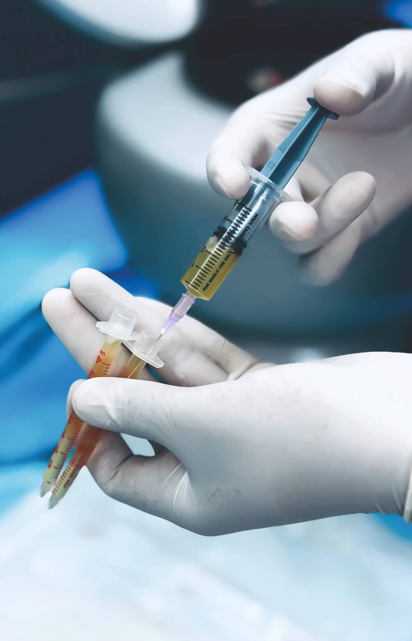 Best PRP Treatment in India: Hair Restoration & Skin Rejuvenation