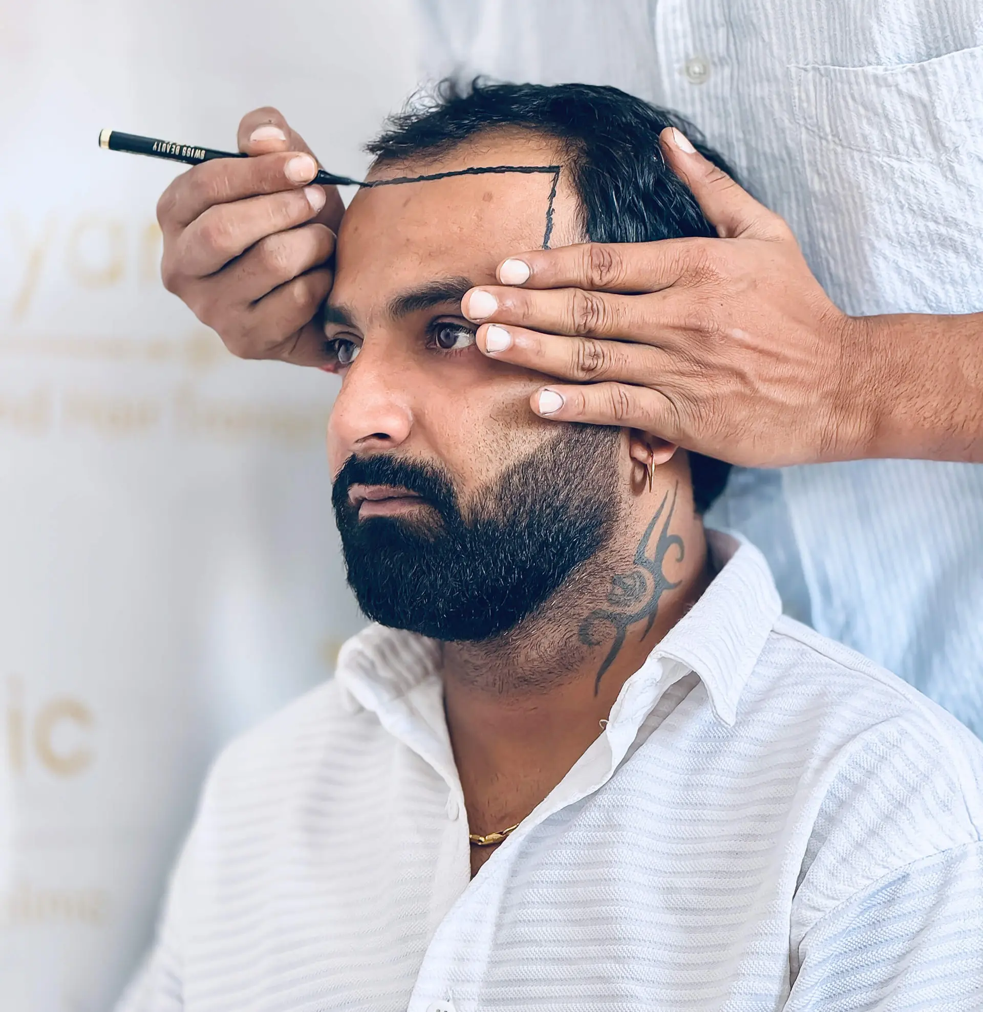Best Hair Fall & Hair Loss Treatment in Delhi — Ryan Clinic Hair Restoration